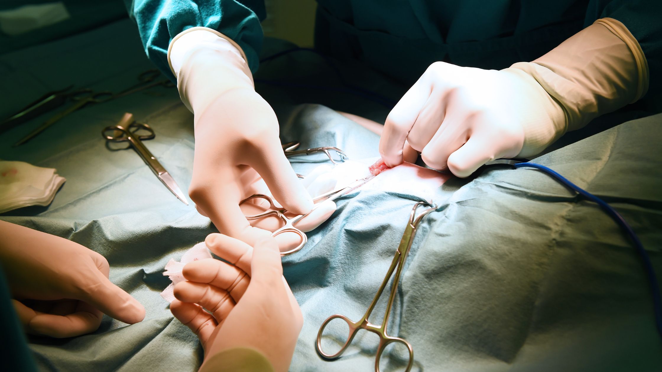 جراحة بطن و غدد صماء