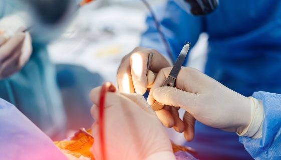 جراحة مخ واعصاب بالغين