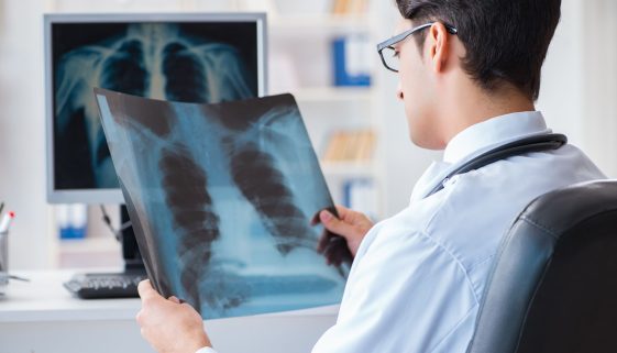 جراحة الصدر عند البالغين