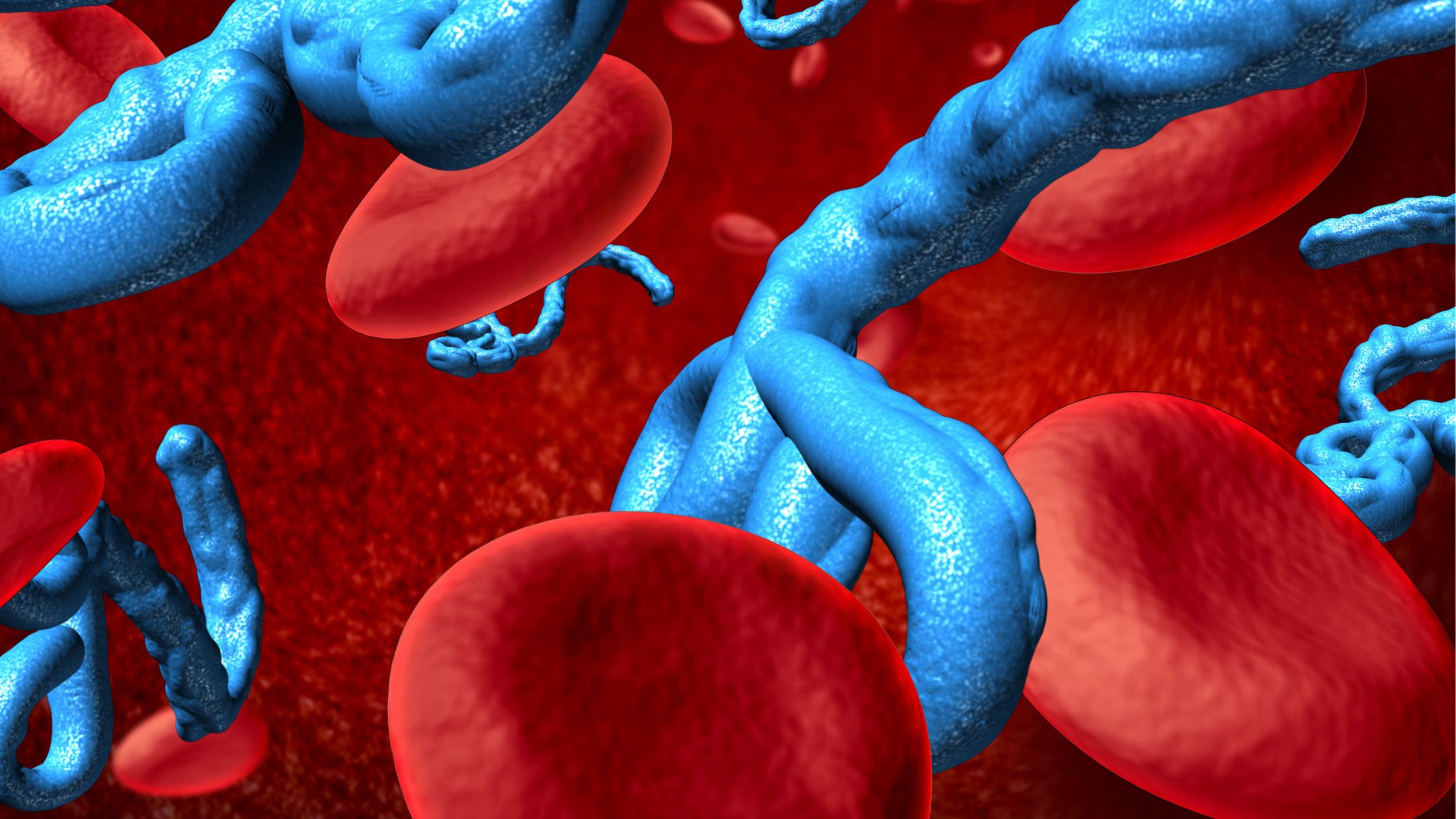 صحة مرضى أمراض الدم