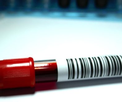 تشخيص وعلاج أمراض الدم