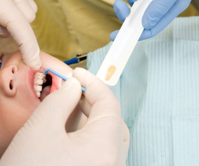 علاجات الفلورايد