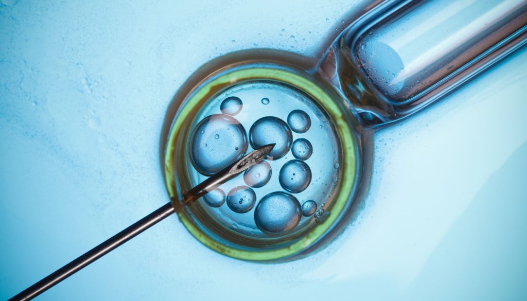 حقن مجهري وتلقيح صناعي