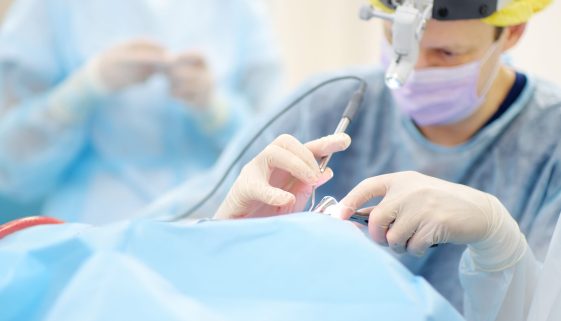 Maxillofacial Surgeries