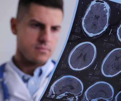 مرضى التصلّب المتعدد