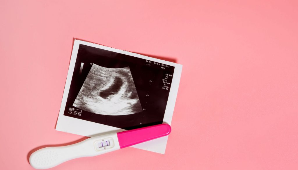 متابعة التبويض والحمل