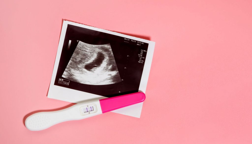 متابعه التبويض ومتابعة الحمل