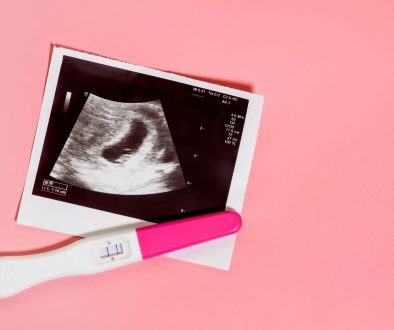 متابعه التبويض ومتابعة الحمل