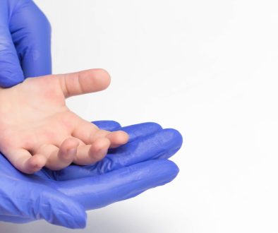 جراحة عظام اطفال