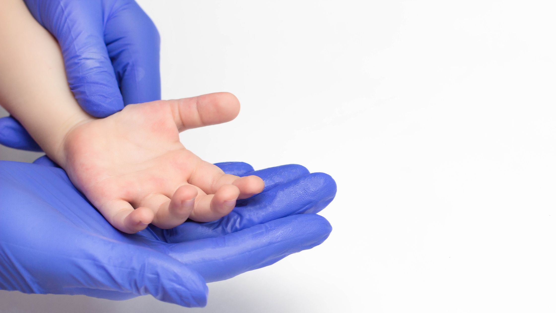 جراحة عظام اطفال