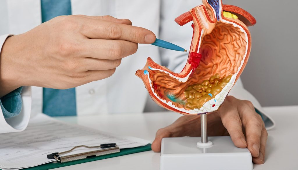 التقرحات والأورام الهضمية