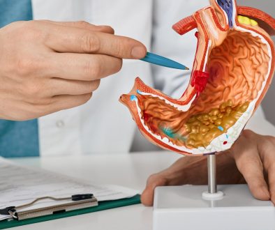 التقرحات والأورام الهضمية