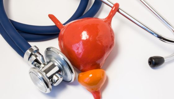 عمليات البروستاتا بالليزر