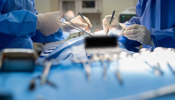 تعافي-بعد-جراحة-الاوعية-الدموية