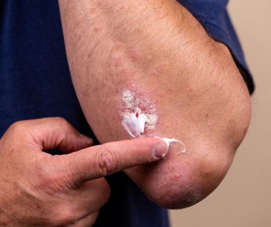 العناية بالأمراض الجلدية