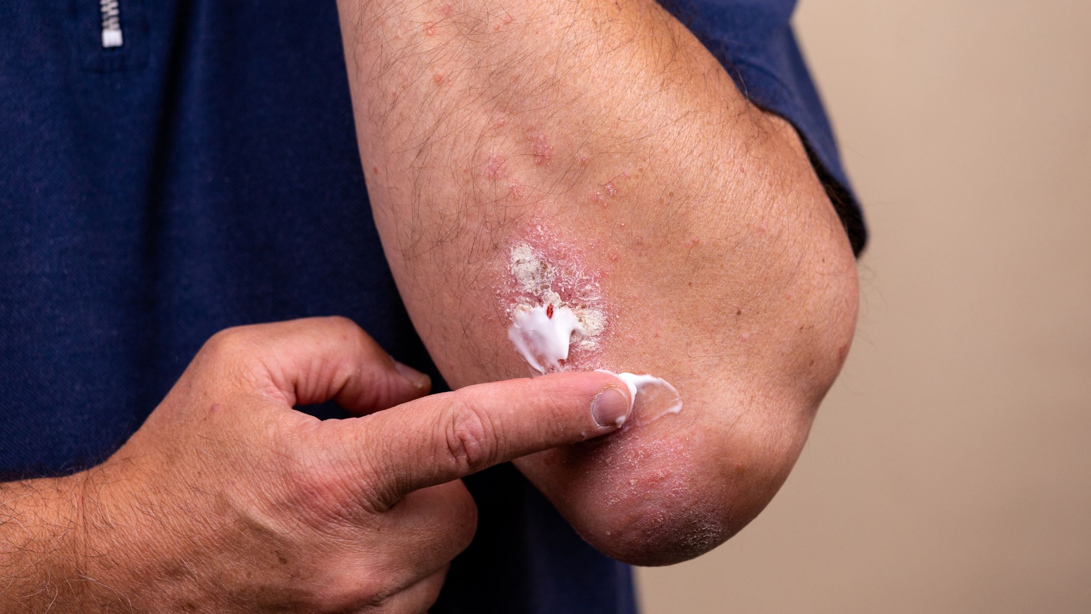 العناية بالأمراض الجلدية