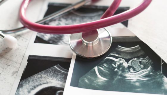 علاج تأخر الإنجاب عند النساء