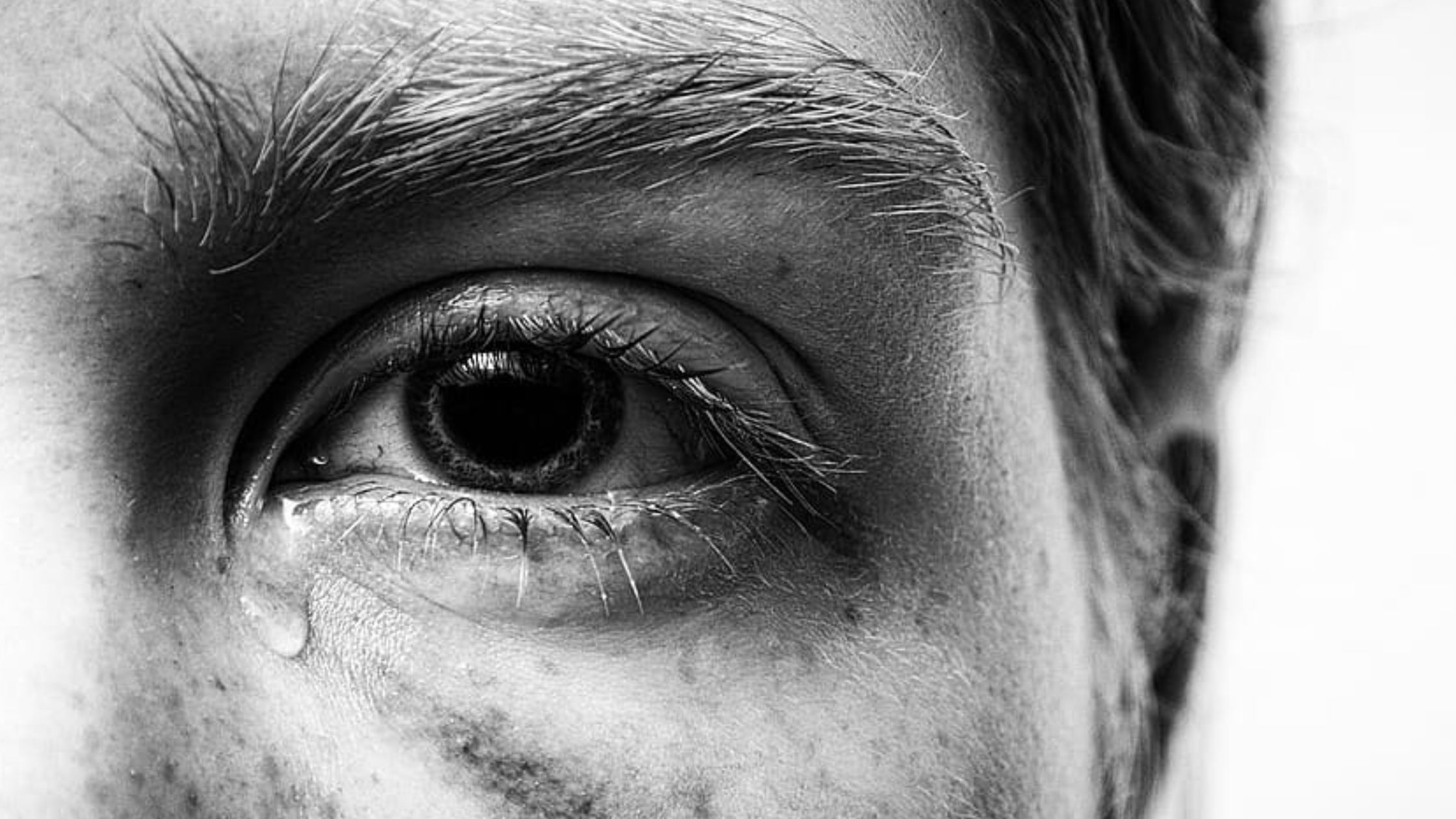 علاج فرط الدموع