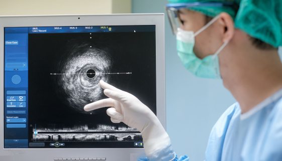 فهم-جراحة-صمامات-المخ-والقسطرة-المخية