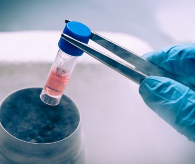 زرع النخاع والخلايا الجذعية