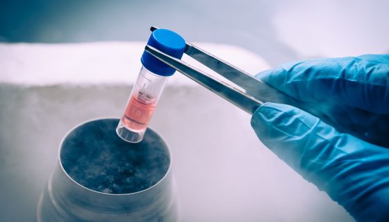 زرع النخاع والخلايا الجذعية