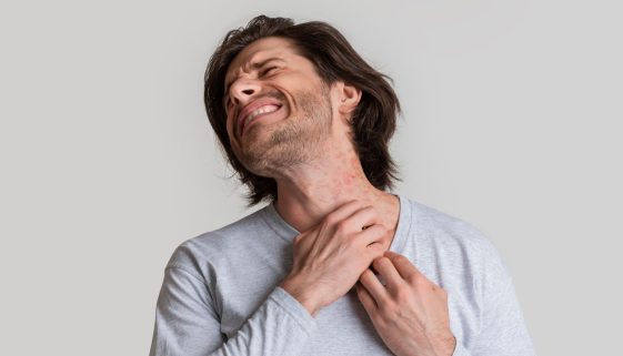 علاج حساسية الجلد